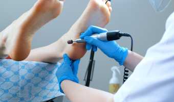 Çatlak Topuk Bakımı