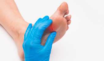 Diyabetik Ayak Bakımı